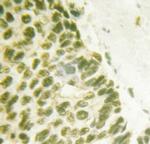 Phospho-FANCD2 (Ser222) Antibody in Immunohistochemistry (Paraffin) (IHC (P))