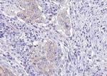 Phospho-WNK1 (Thr60) Antibody in Immunohistochemistry (Paraffin) (IHC (P))