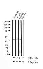 Phospho-DARPP-32 (Thr75) Antibody in Western Blot (WB)