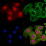 Phospho-HDAC5 (Ser259) Antibody in Immunocytochemistry (ICC/IF)