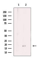 IL-1 beta (Cleaved Asp116) Antibody in Western Blot (WB)