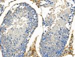 Phospho-Claudin 5 (Thr207 ) Antibody in Immunohistochemistry (Paraffin) (IHC (P))