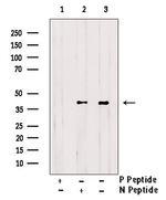 Phospho-CK1 alpha (Thr321) Antibody in Western Blot (WB)