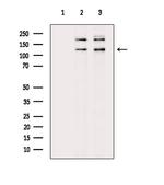 Phospho-53BP2 (Ser698) Antibody in Western Blot (WB)