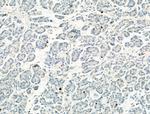 Phospho-NLRP3 (Ser295) Antibody in Immunohistochemistry (Paraffin) (IHC (P))