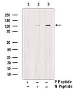 Phospho-alpha Actinin 1 (Tyr193) Antibody in Western Blot (WB)