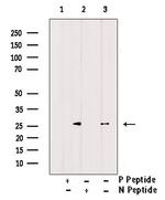 Phospho-PPP1R8 (Ser199) Antibody in Western Blot (WB)