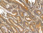 Phospho-NEDD4 (Ser670) Antibody in Immunohistochemistry (Paraffin) (IHC (P))