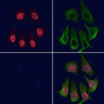 Phospho-BRG1 (Ser610) Antibody in Immunocytochemistry (ICC/IF)