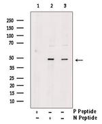 Phospho-PAR1 (Tyr420) Antibody in Western Blot (WB)