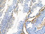 Phospho-LRP5 (Tyr1473) Antibody in Immunohistochemistry (Paraffin) (IHC (P))