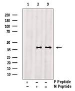 Phospho-CD32 (Tyr288) Antibody in Western Blot (WB)