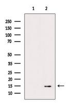 H2BK16ac Antibody in Western Blot (WB)