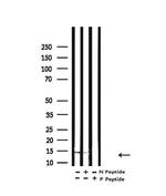 H2BK16ac Antibody in Western Blot (WB)