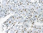 H2BK16ac Antibody in Immunohistochemistry (Paraffin) (IHC (P))