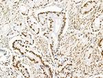 H2BK16ac Antibody in Immunohistochemistry (Paraffin) (IHC (P))