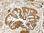 H2BK16ac Antibody in Immunohistochemistry (Paraffin) (IHC (P))