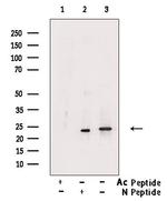 Acetyl-SOD2 (Lys122) Antibody in Western Blot (WB)