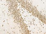 H3K122ac Antibody in Immunohistochemistry (Paraffin) (IHC (P))