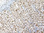 H3K122ac Antibody in Immunohistochemistry (Paraffin) (IHC (P))