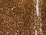 H3K122ac Antibody in Immunohistochemistry (Paraffin) (IHC (P))