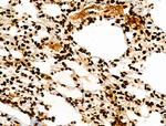 H3K122ac Antibody in Immunohistochemistry (Paraffin) (IHC (P))