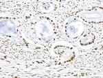 Acetyl-p53 (Lys373) Antibody in Immunohistochemistry (Paraffin) (IHC (P))