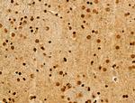 Acetyl-p53 (Lys373) Antibody in Immunohistochemistry (Paraffin) (IHC (P))