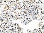 Acetyl-p53 (Lys373) Antibody in Immunohistochemistry (Paraffin) (IHC (P))