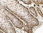 Acetyl-p53 (Lys373) Antibody in Immunohistochemistry (Paraffin) (IHC (P))