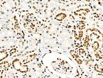 Acetyl-p53 (Lys381) Antibody in Immunohistochemistry (Paraffin) (IHC (P))