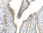 Acetyl-p53 (Lys381) Antibody in Immunohistochemistry (Paraffin) (IHC (P))