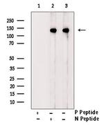 Phospho-ATP Citrate Lyase (Ser455, Ser457) Antibody in Western Blot (WB)