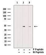 Phospho-eIF4A2 (Tyr49) Antibody in Western Blot (WB)