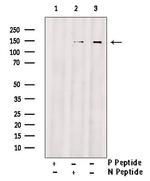 Phospho-EphA4 (Tyr596) Antibody in Western Blot (WB)