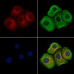 Phospho-LAT (Tyr220) Antibody in Immunocytochemistry (ICC/IF)