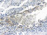 Phospho-LAT (Tyr220) Antibody in Immunohistochemistry (Paraffin) (IHC (P))