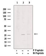 Phospho-LAT (Tyr220) Antibody in Western Blot (WB)