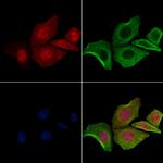 Phospho-delta Catenin (Ser320) Antibody in Immunocytochemistry (ICC/IF)