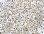 Phospho-delta Catenin (Ser320) Antibody in Immunohistochemistry (Paraffin) (IHC (P))