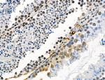 Phospho-delta Catenin (Ser320) Antibody in Immunohistochemistry (Paraffin) (IHC (P))