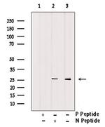 Phospho-Bcl-2 (Thr56) Antibody in Western Blot (WB)