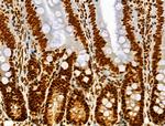 Phospho-SRF (Ser103) Antibody in Immunohistochemistry (Paraffin) (IHC (P))