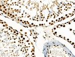 Phospho-SRF (Ser103) Antibody in Immunohistochemistry (Paraffin) (IHC (P))