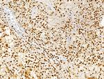 Phospho-SRC (Ser17) Antibody in Immunohistochemistry (Paraffin) (IHC (P))