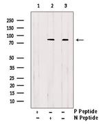 Phospho-HCLS1 (Tyr397) Antibody in Western Blot (WB)