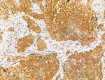 Phospho-NR4A1 (Ser351) Antibody in Immunohistochemistry (Paraffin) (IHC (P))