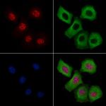 Phospho-AKT1 (Ser124) Antibody in Immunocytochemistry (ICC/IF)