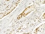 Phospho-AKT1 (Ser124) Antibody in Immunohistochemistry (Paraffin) (IHC (P))