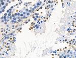 Phospho-AKT1 (Ser124) Antibody in Immunohistochemistry (Paraffin) (IHC (P))